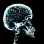 UNM Neurosurgery Silent on Alleged Harm to Young Patient by Misuse of IRRAflow Device, and Report to Risk Management/Safety Committees